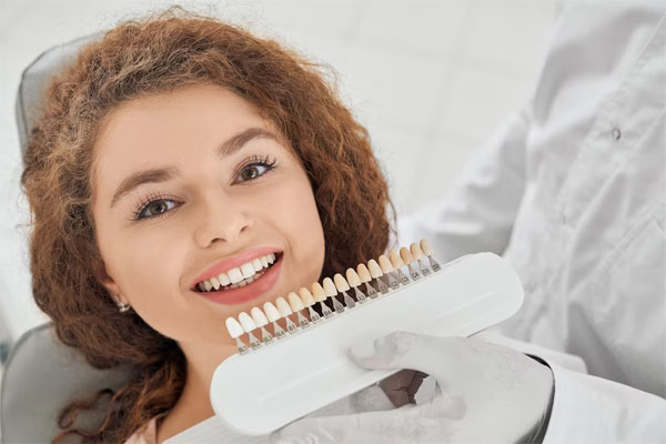 Dental Veneers